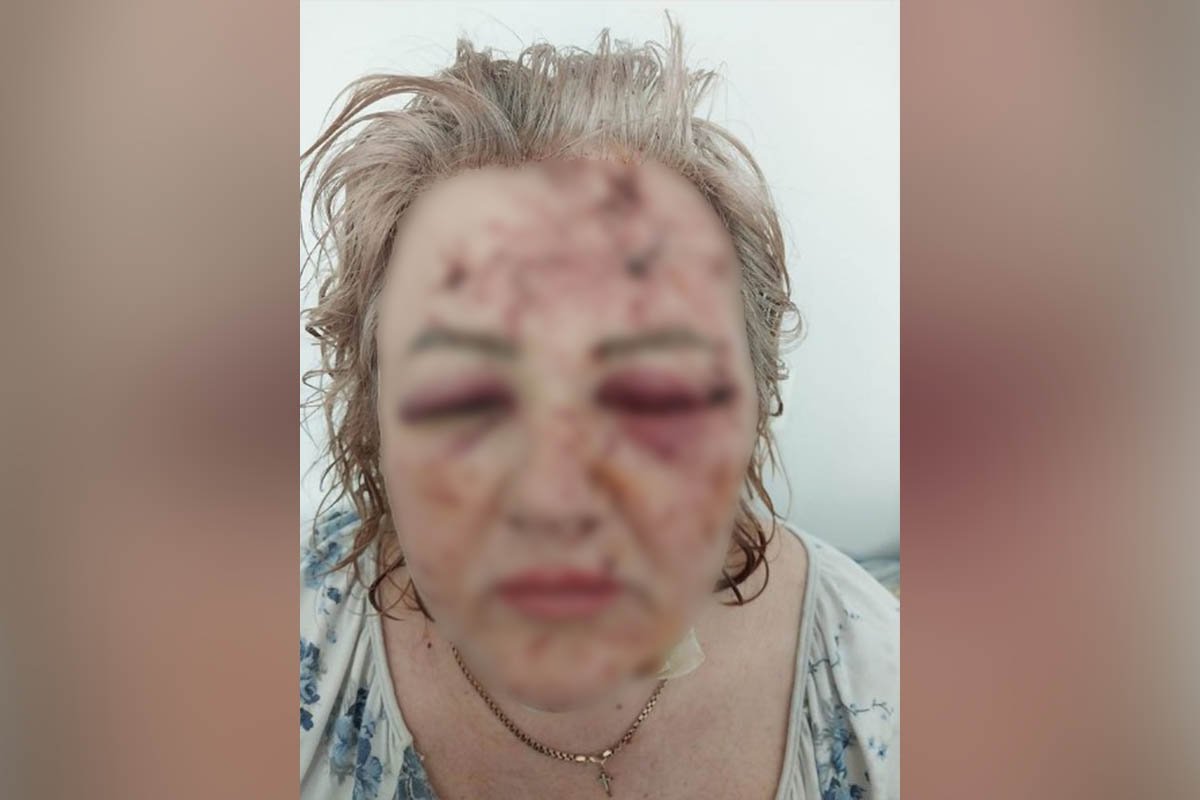 Жінка постраждала внаслідок ракетної атаки 26 травня 