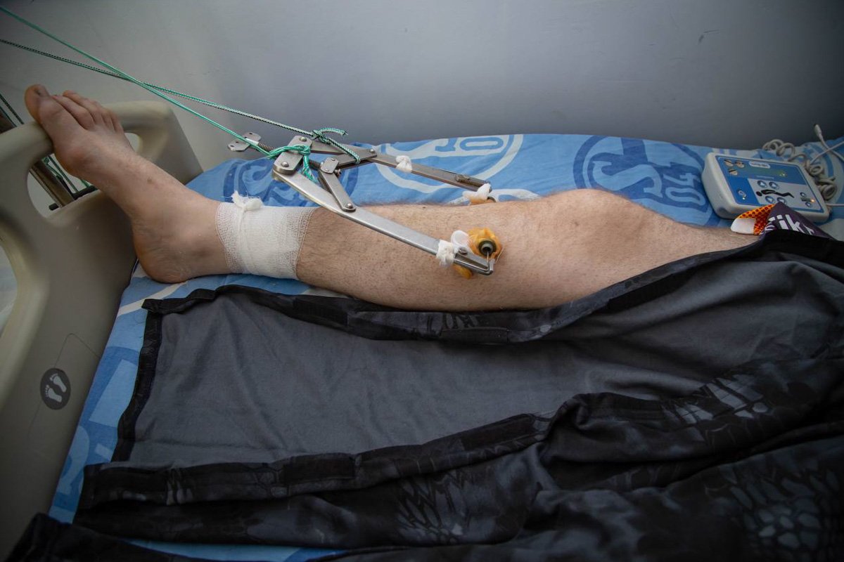 Також фонд "Nova Ukraine" також допомагає з апаратами АЗФ Також фонд "Nova Ukraine" також допомагає з апаратами АЗФ