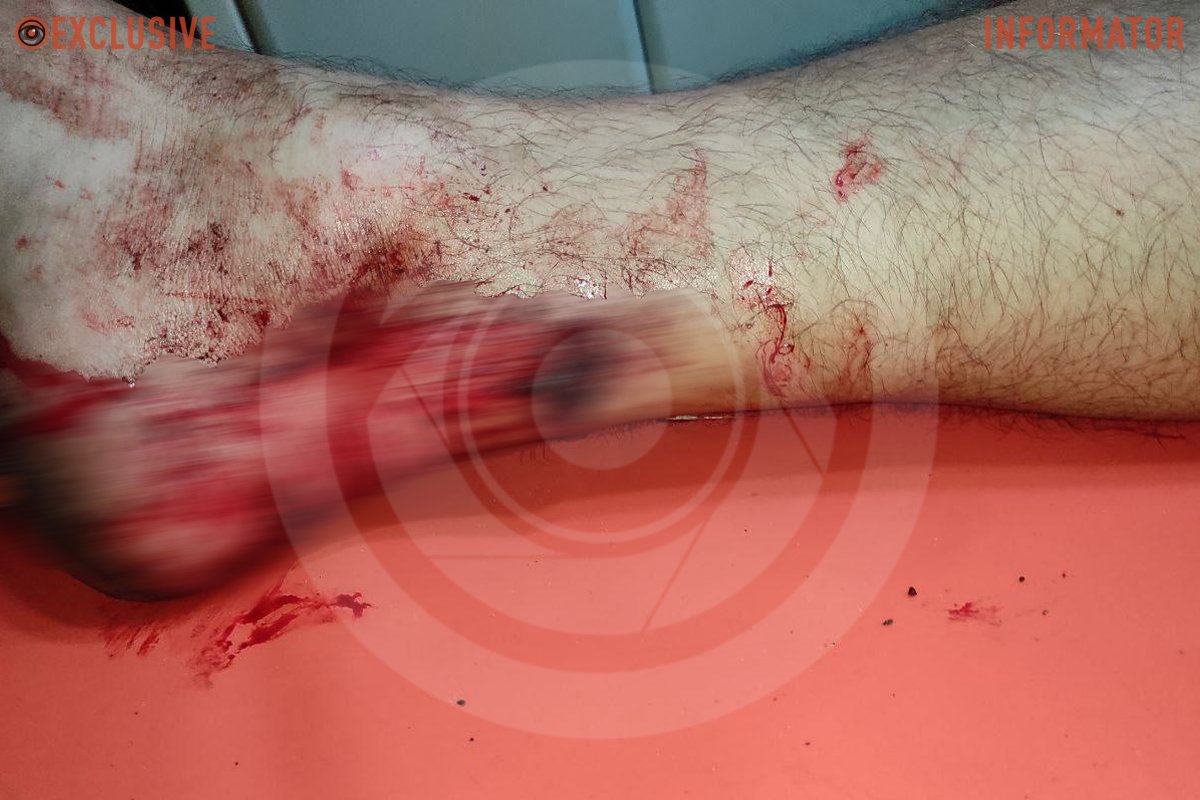 У Дніпрі поранили водія вантажівки