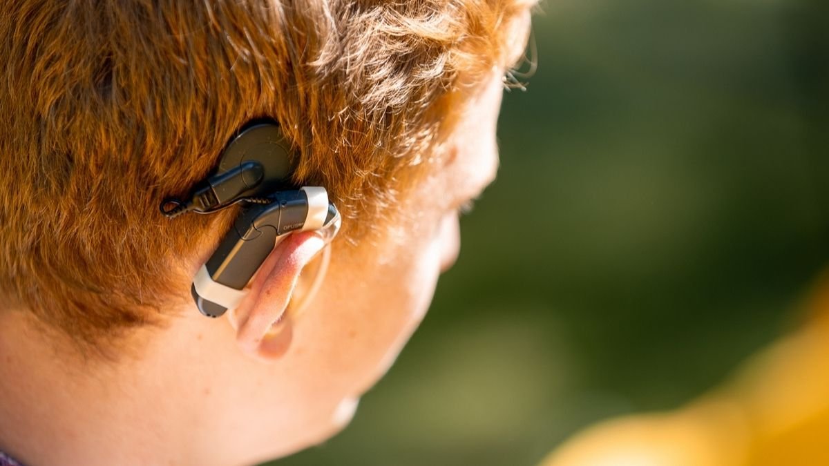 Приобретенные кохлеарные импланты за счет государственного бюджета Приобретенные кохлеарные импланты на средства государственного бюджета