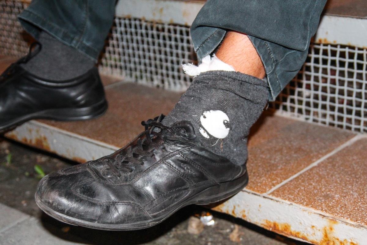 Мопедисту переехало левую ногу