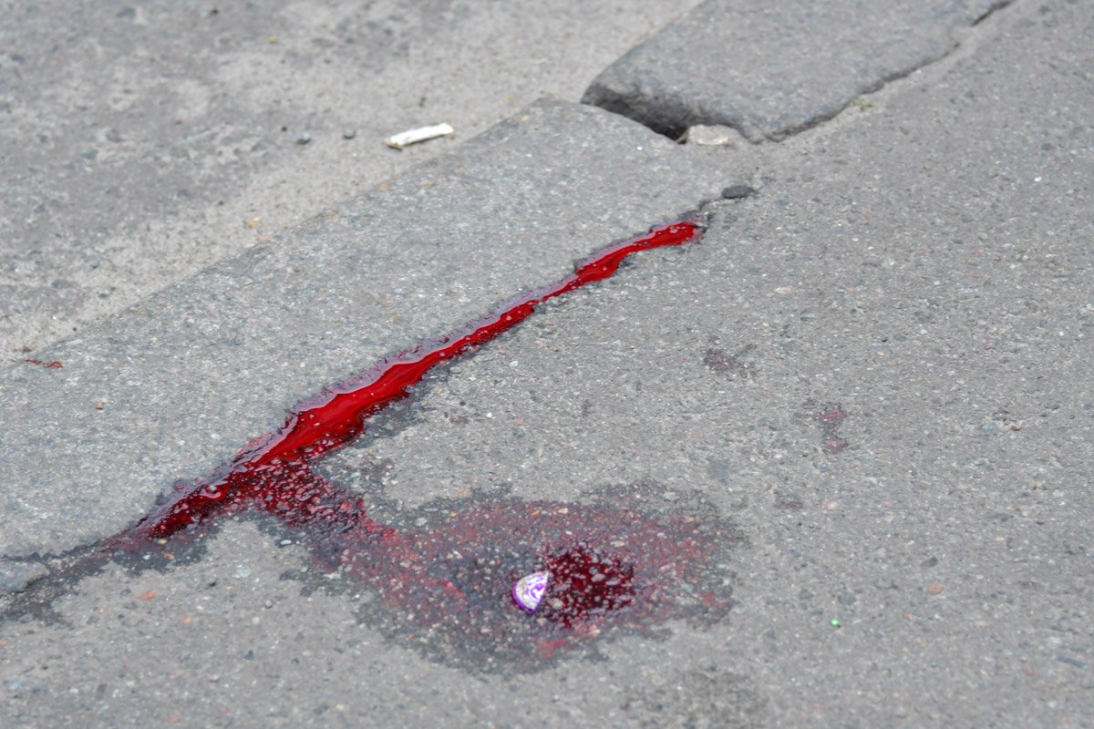 От удара женщину отбросило на несколько метров, она ударилась головой о бордюр