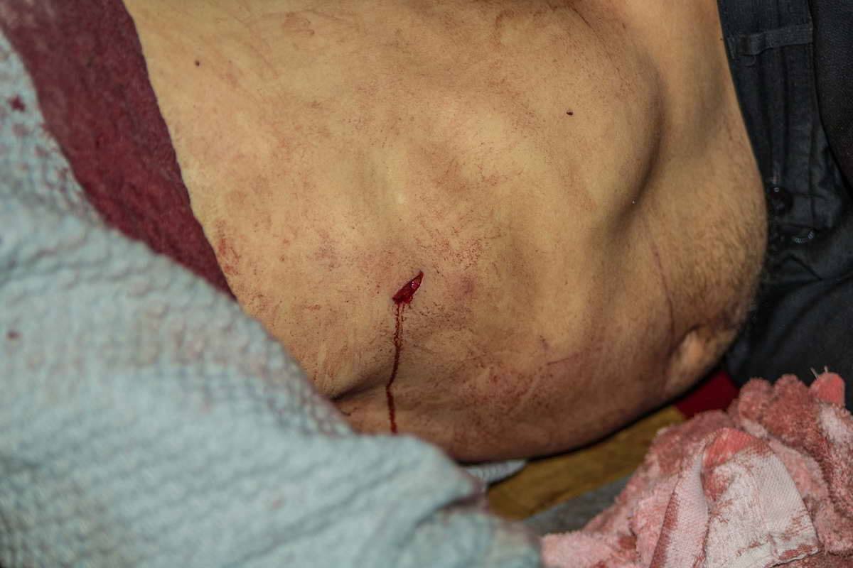 Мужчину убили одним ударом в сердце