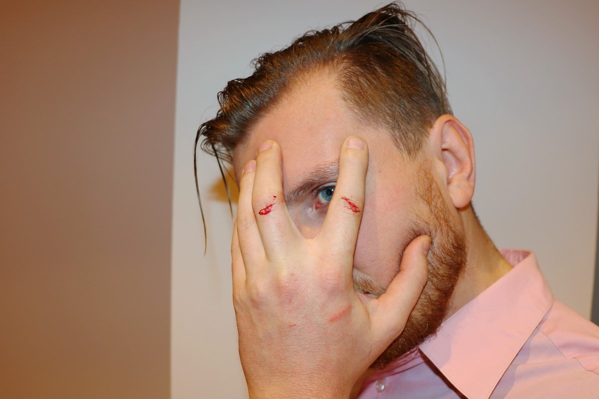 Наш оператор защищал камеру и в результате пострадал