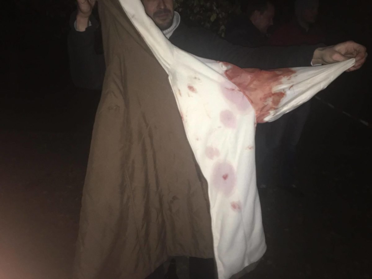 Прохожий подложил свою куртку под голову одному из пострадавших