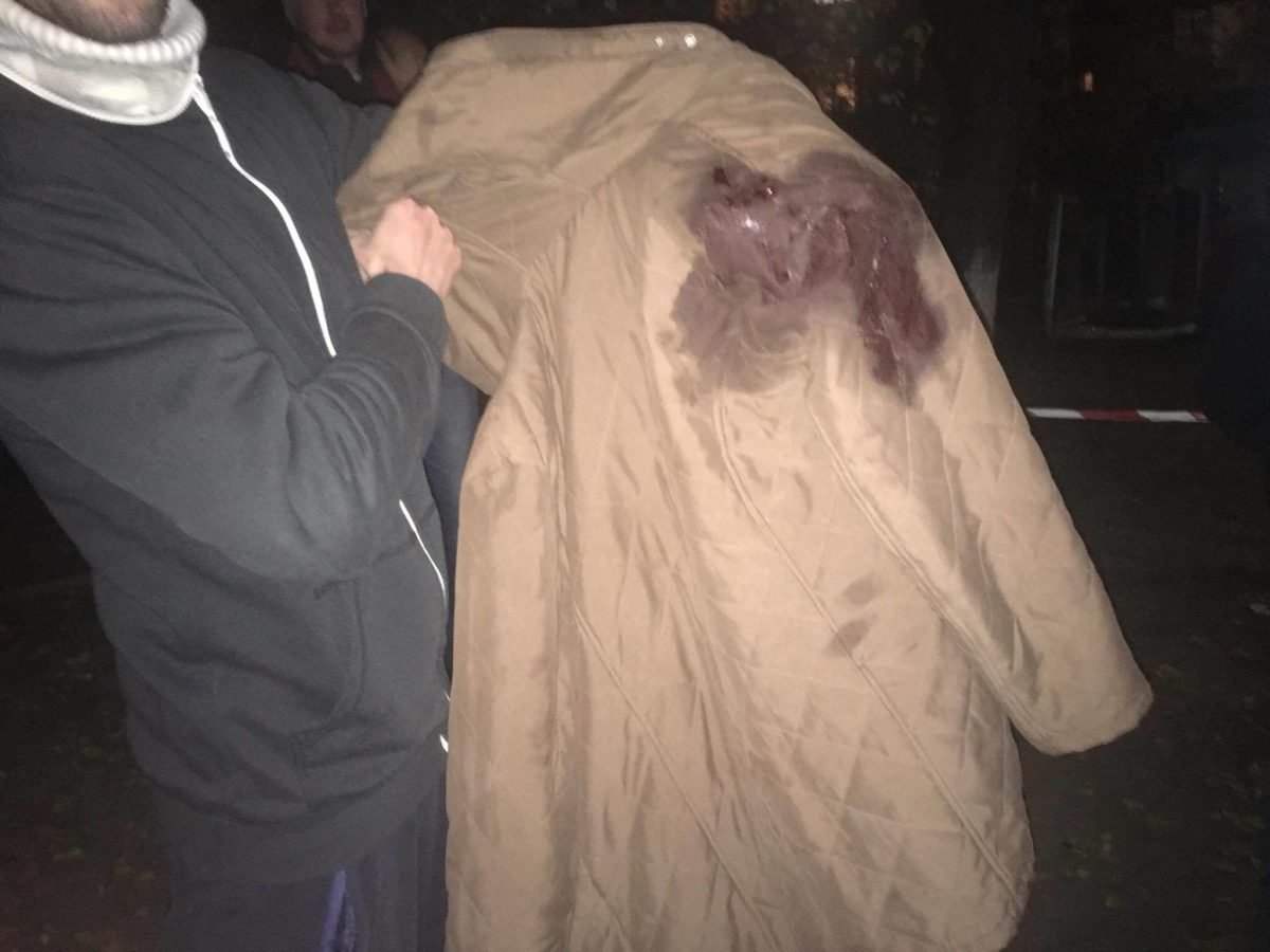 Так выглядят последствия взрыва: на месте было много крови