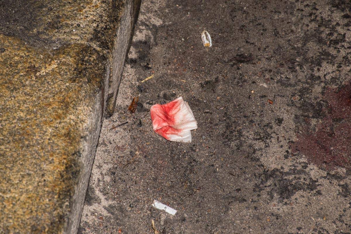 Сбитого мужчину с тяжелыми травмами госпитализировали