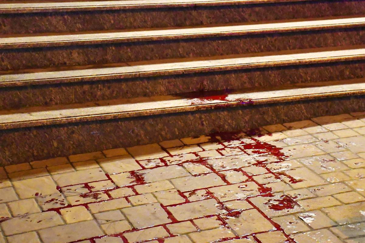 Пострадавший получил ножевые ранения