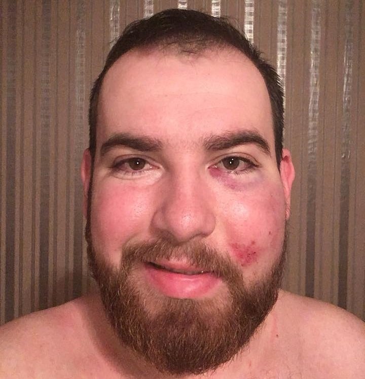 Пострадавший Евгений Булда Пострадавший Евгений Булда