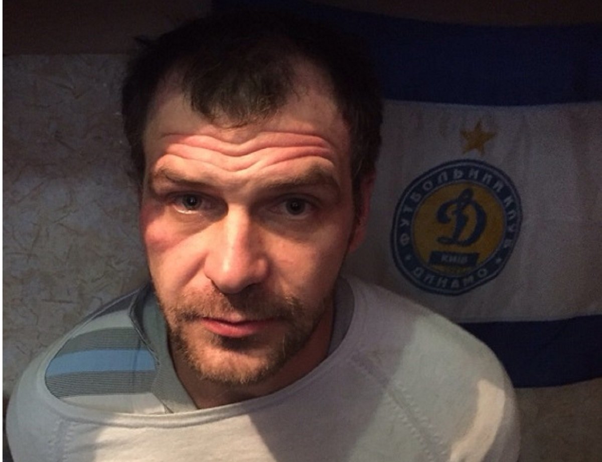 В Киеве задержали 35-летнего жителя Закарпатья. Вместе с молодой девушкой он напаивал людей клофелином, а после - грабил