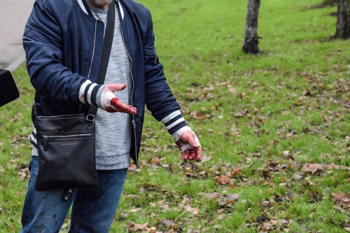 Из-за столкновения у водителя BMW руки в крови Из-за столкновения у водителя BMW руки в крови