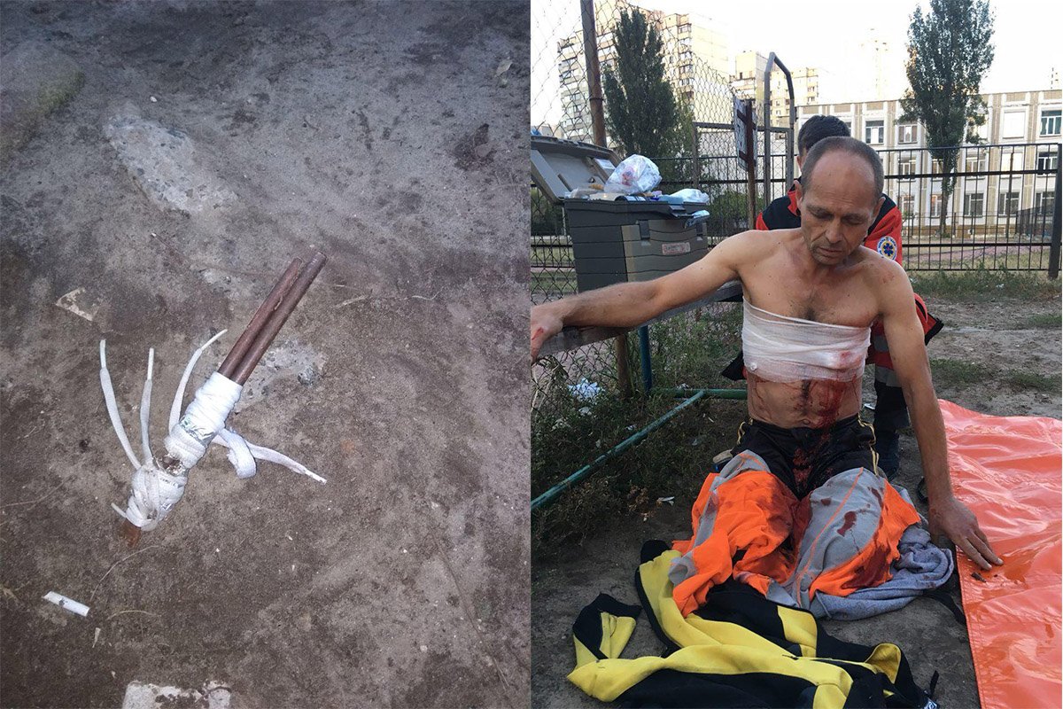 26 сентября в Киеве по адресу Срибнокольская, 8а мужчина стрелял сам в себя 26 сентября в Киеве по адресу Срибнокольская, 8а мужчина стрелял сам в себя