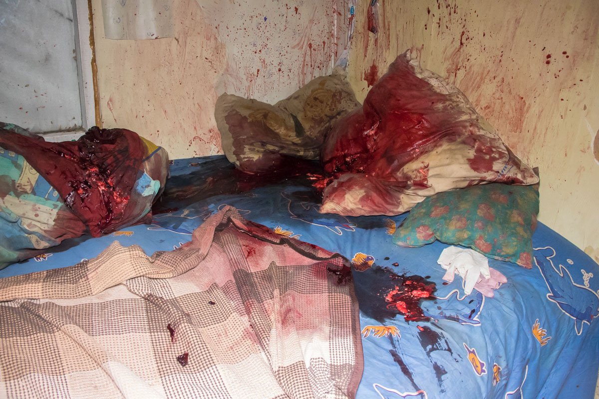 Во сне на мужчину напали и нанесли множество ударов молотком по голове