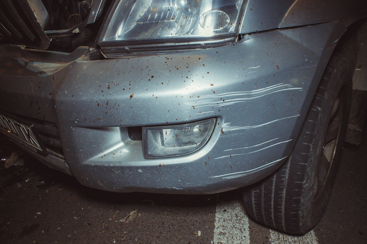 Владелец Toyota поранил руку от удара Владелец Toyota поранил руку от удара