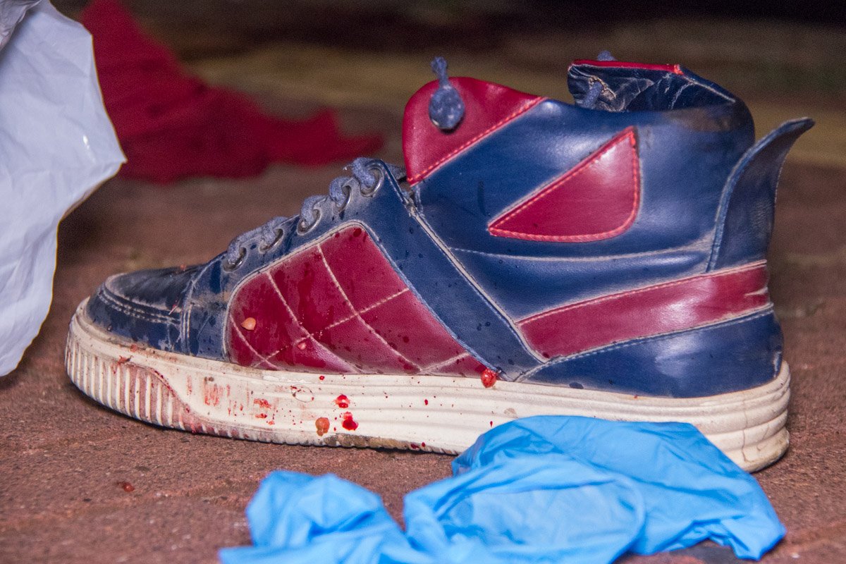 В результате инцидента, пострадавшему отрезало ступню