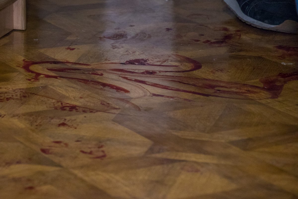 Отца Мазура госпитализировали в больницу с ранениями ног и потерей крови