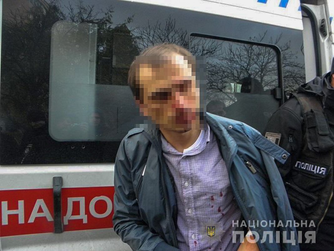 Очевидцы случившегося задержали одного из подозреваемых Очевидцы случившегося задержали одного из подозреваемых