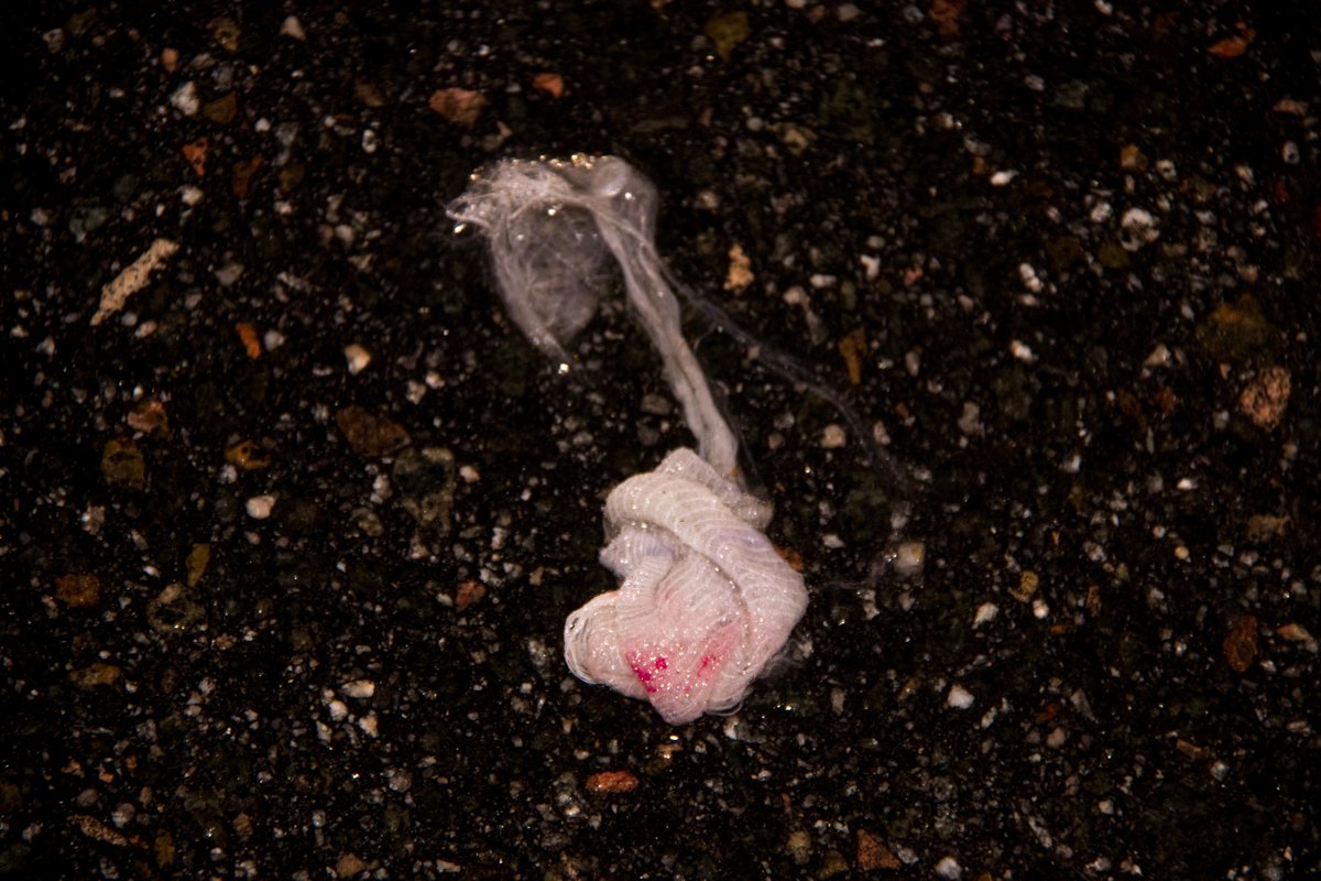 По предварительной информации, пешехода госпитализировали с переломом обеих ног и травмами головы