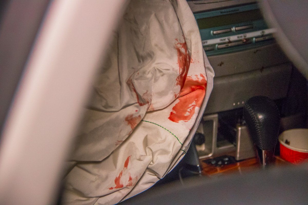 Мужчина получил незначительную травму головы