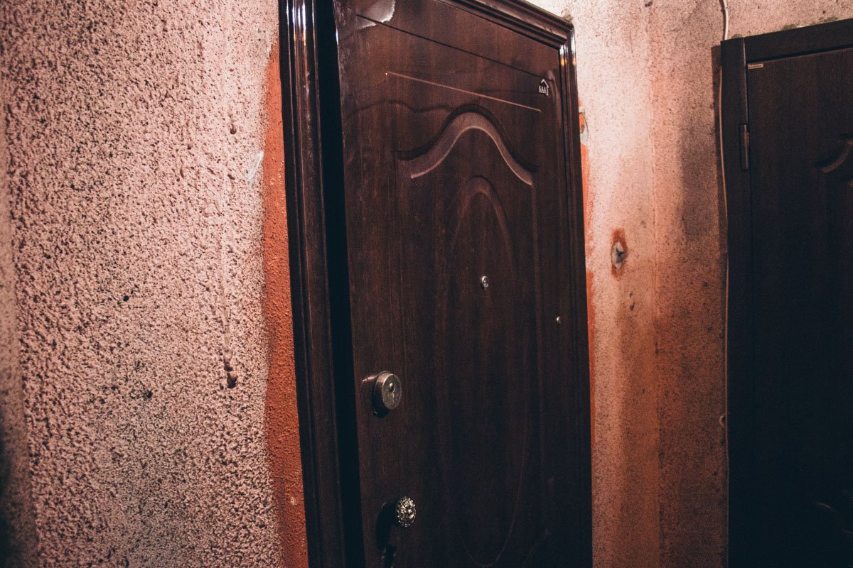 У женщины был перелом тазобедренного сустава и она не могла ходить уже 3 года У женщины был перелом тазобедренного сустава и она не могла ходить уже 3 года