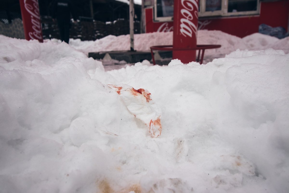 В результате произошедшего мужчине нанесли несколько ножевых ранений и били стулом по голове
