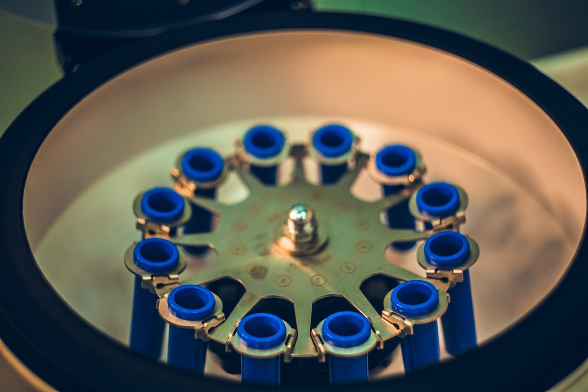 В центрифуге получают необходимый материал для увеличения губ