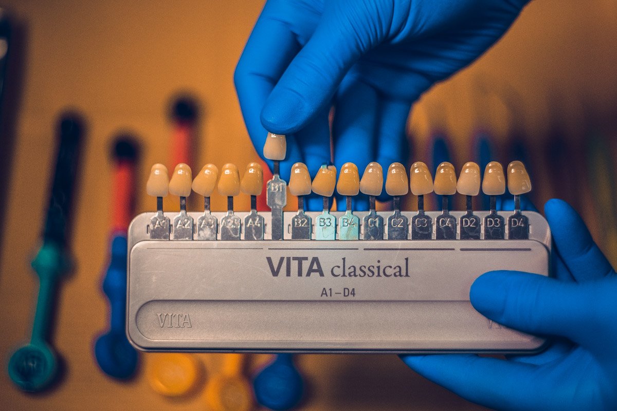 В клинике пациенту предлагают услуги по имплантации и протезированию