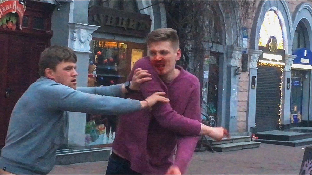 В итоге, у одного из участников драки разбито лицо