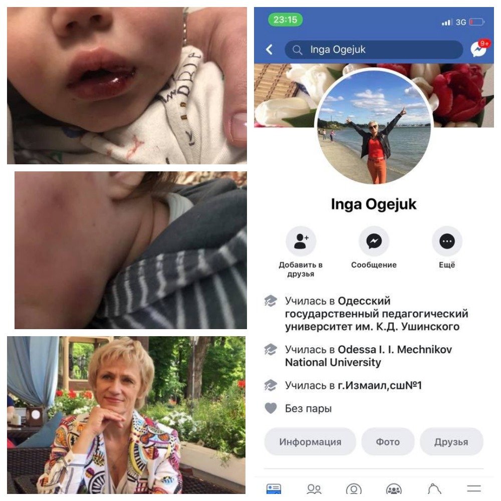 В Одессе пьяная няня избила годовалого малыша В Одессе пьяная няня избила годовалого малыша