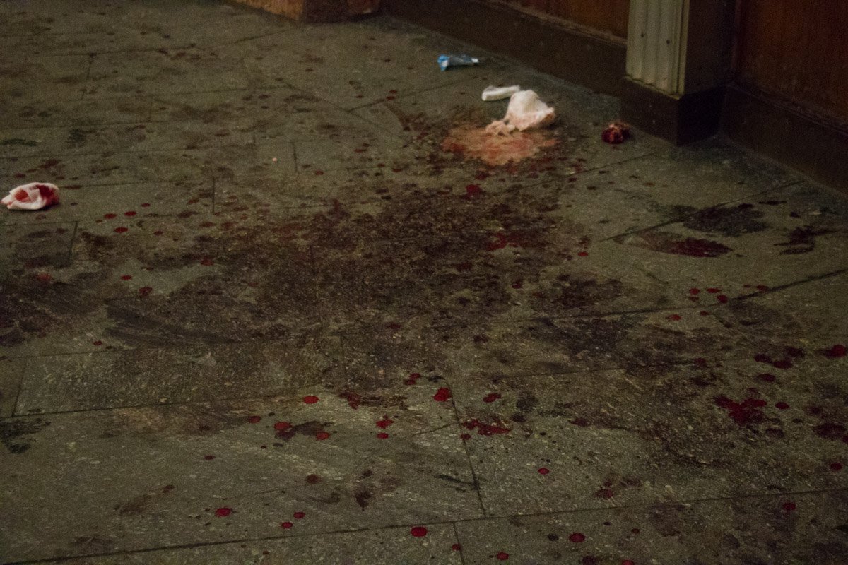 Потерпевшего госпитализировали с травмами средней тяжести Потерпевшего госпитализировали с травмами средней тяжести