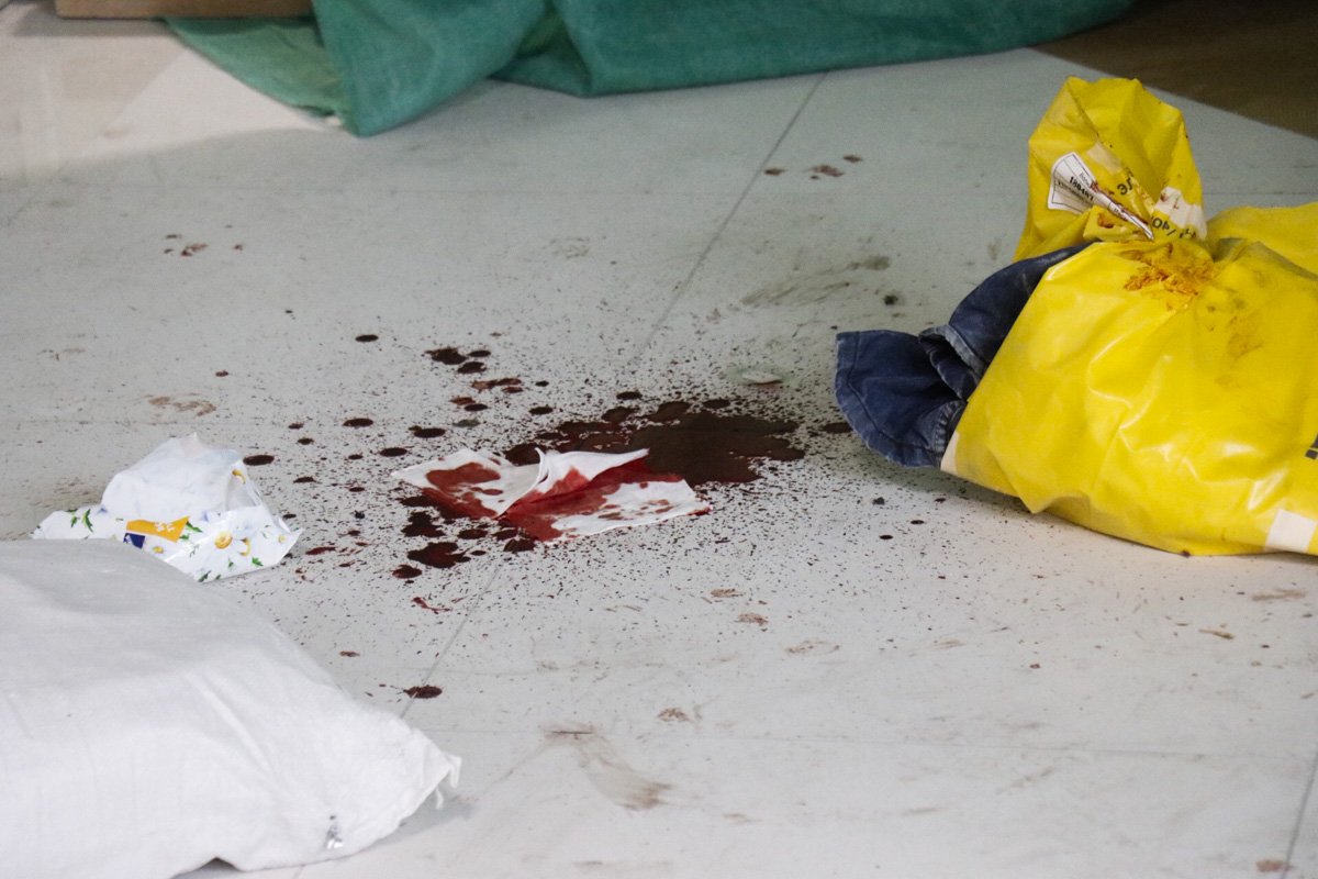 Граната взорвалась в руках у рабочего и повредила ему кисть