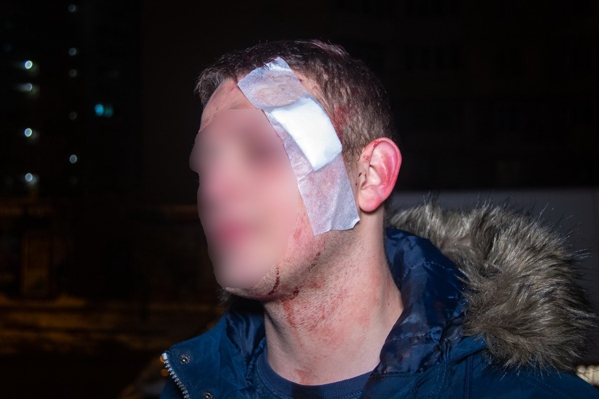 В результате потасовки несколько человек получили травмы