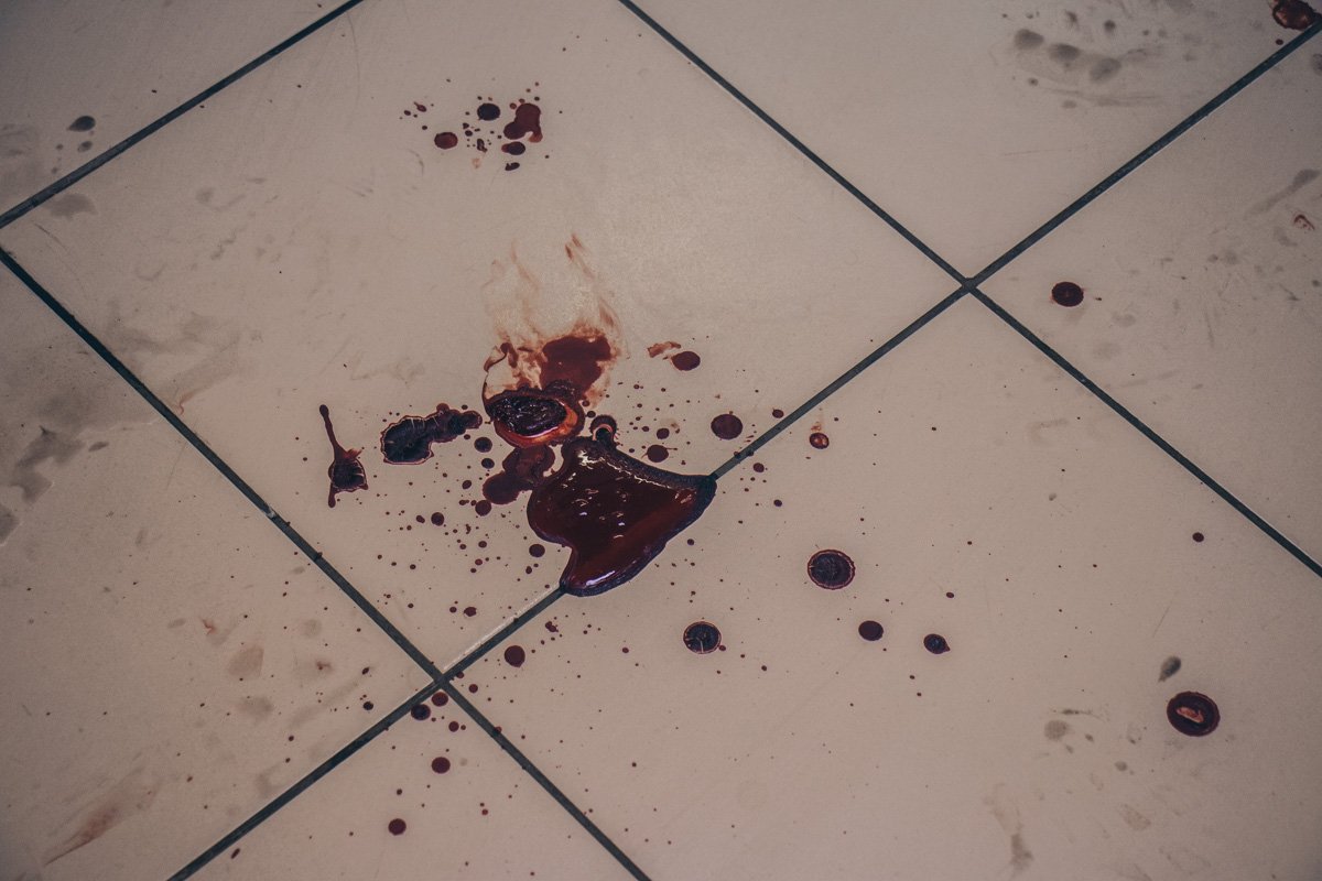 Один из мужчин зашел окровавленный на заправку и потерял сознание