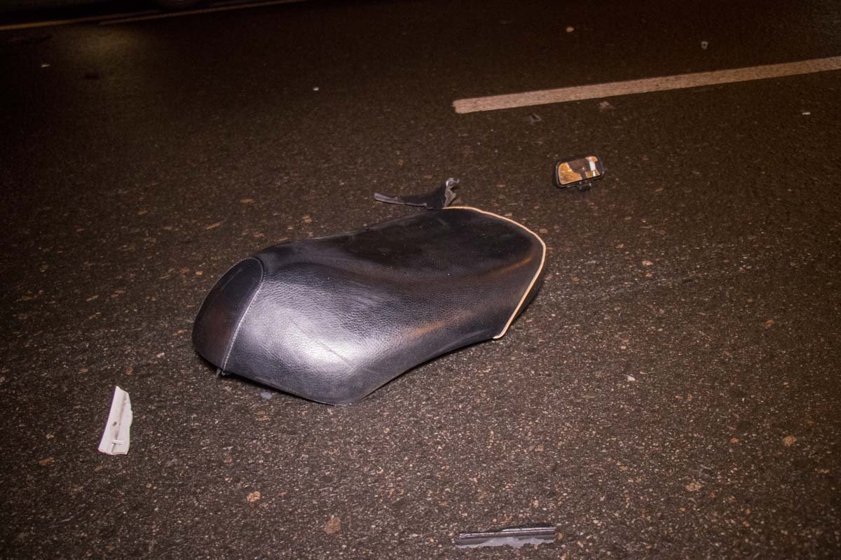 Курьер получил перелом ноги Курьер получил перелом ноги