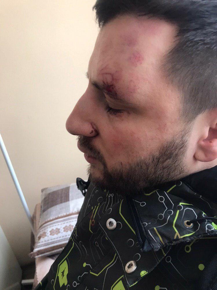 Александр получил множество повреждений мягких тканей лица Александр получил множество повреждений мягких тканей лица