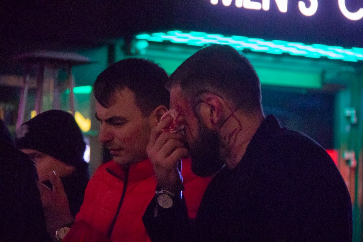 Кто-то из молодых парней арабской внешности избил выпившего жителя столицы, якобы за то, что он задел мужское достоинство ребят