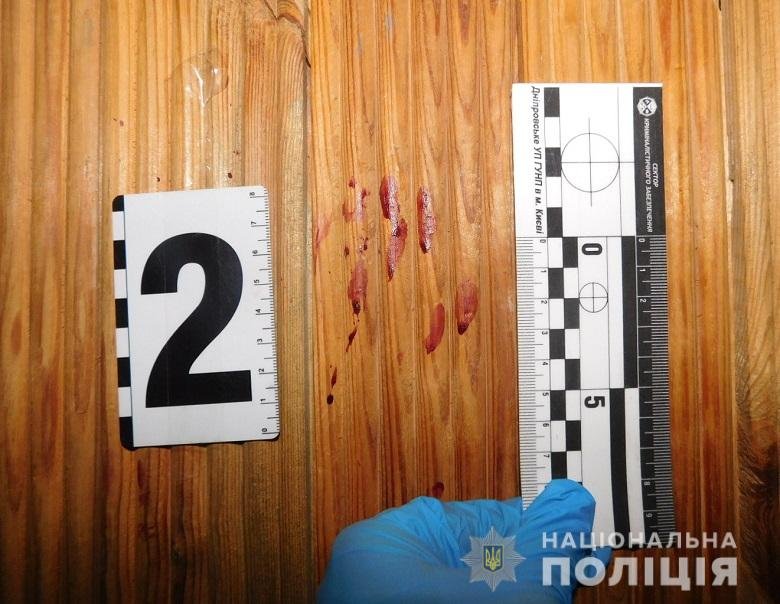 Пострадавшего оперативно госпитализировали и прооперировали, а нападавший скрылся из квартиры на Дарницком бульваре, где случилось преступление