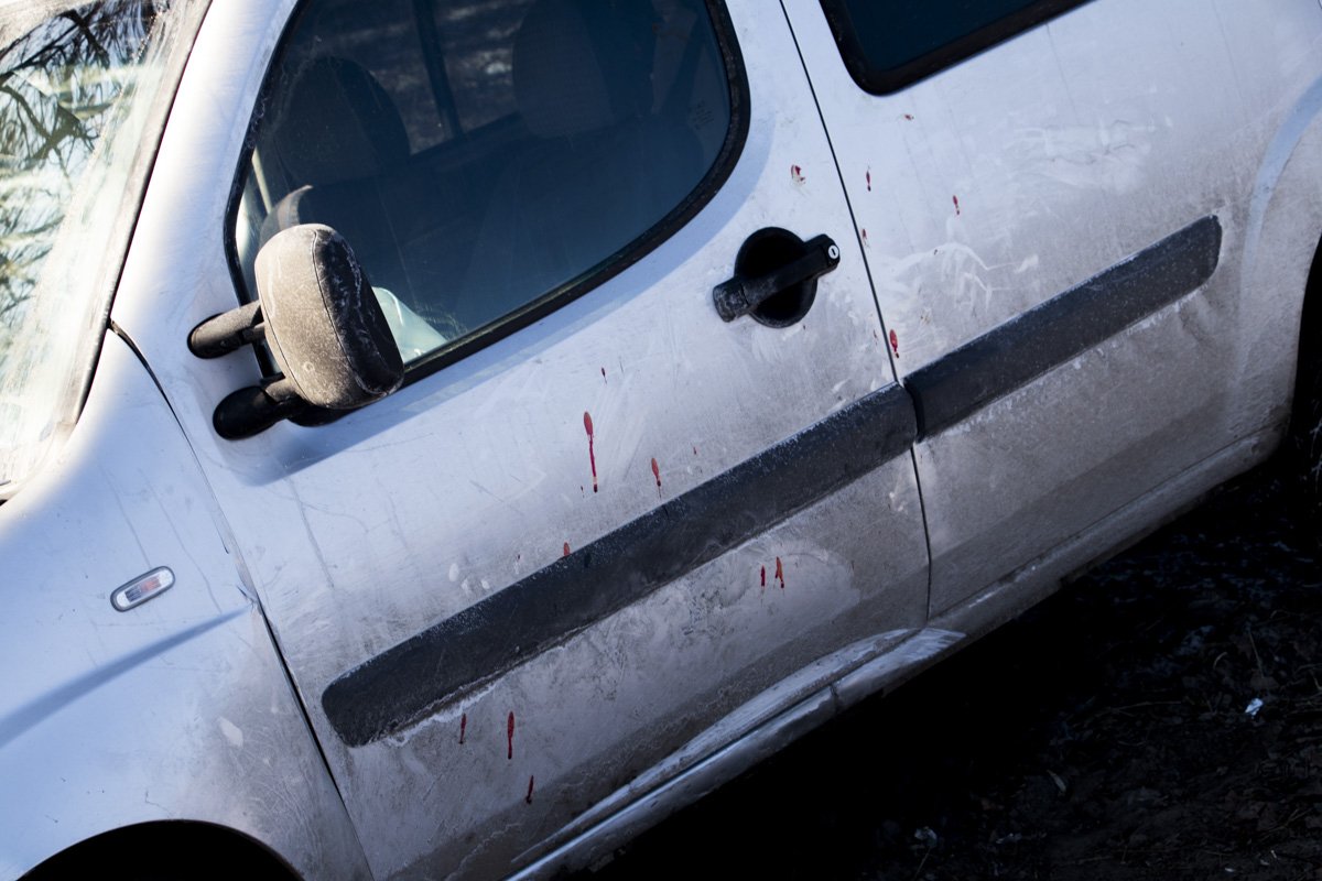 У водителя открытая черепно-мозговая травма У водителя открытая черепно-мозговая травма