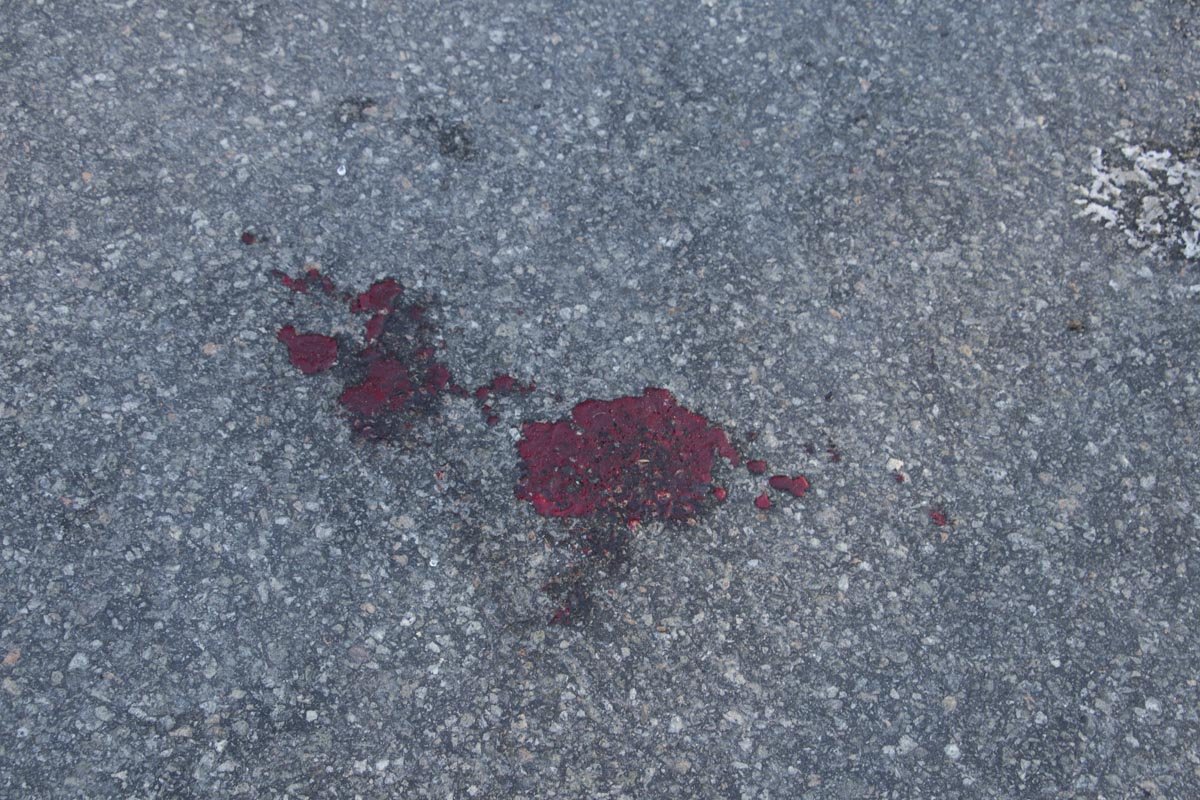 Первую помощь пострадавшему оказывали свидетели Первую помощь пострадавшему оказывали свидетели