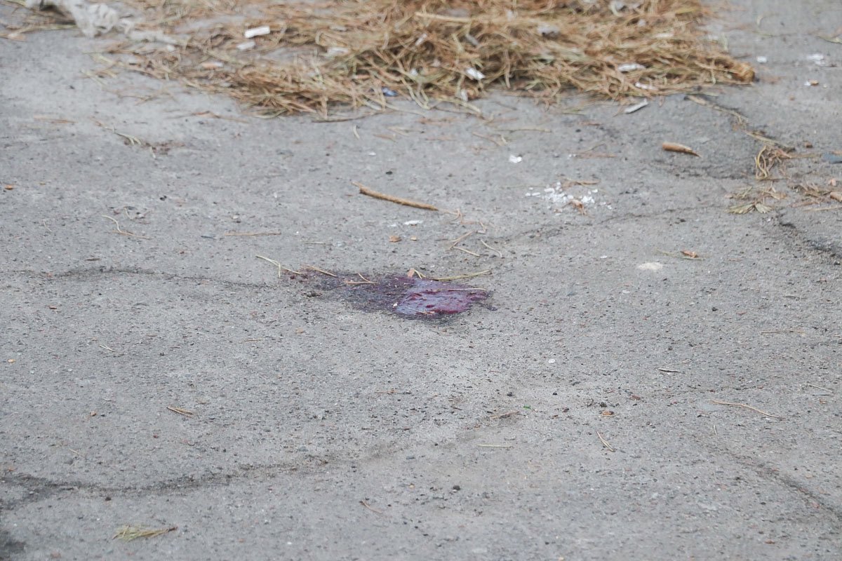  Рядом с головой была кровь