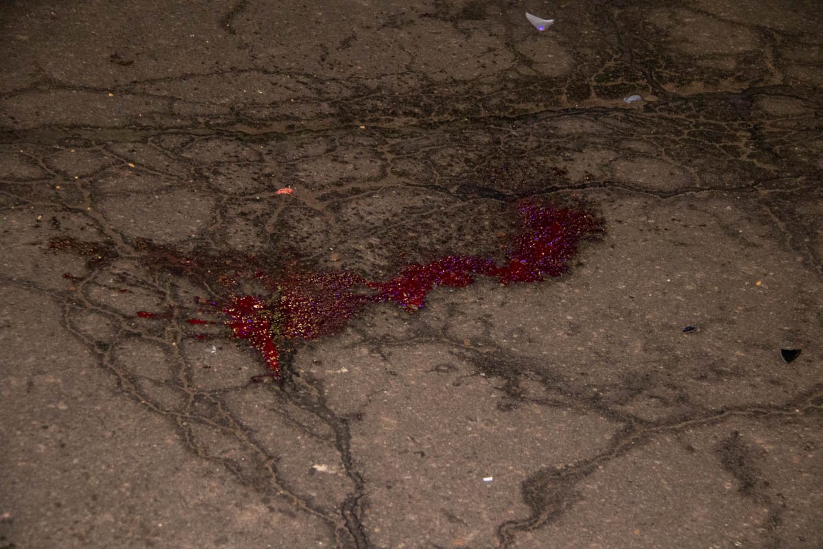 Пострадавшую госпитализировали в больницу