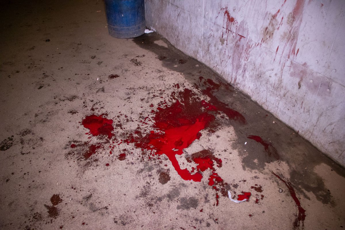 Вокруг пострадавшего уже были множественные следы крови Вокруг пострадавшего уже были множественные следы крови