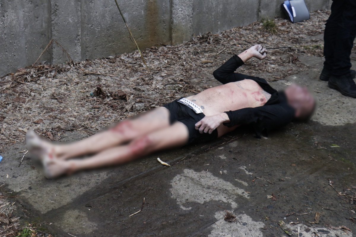 На теле мужчины множество ссадин 