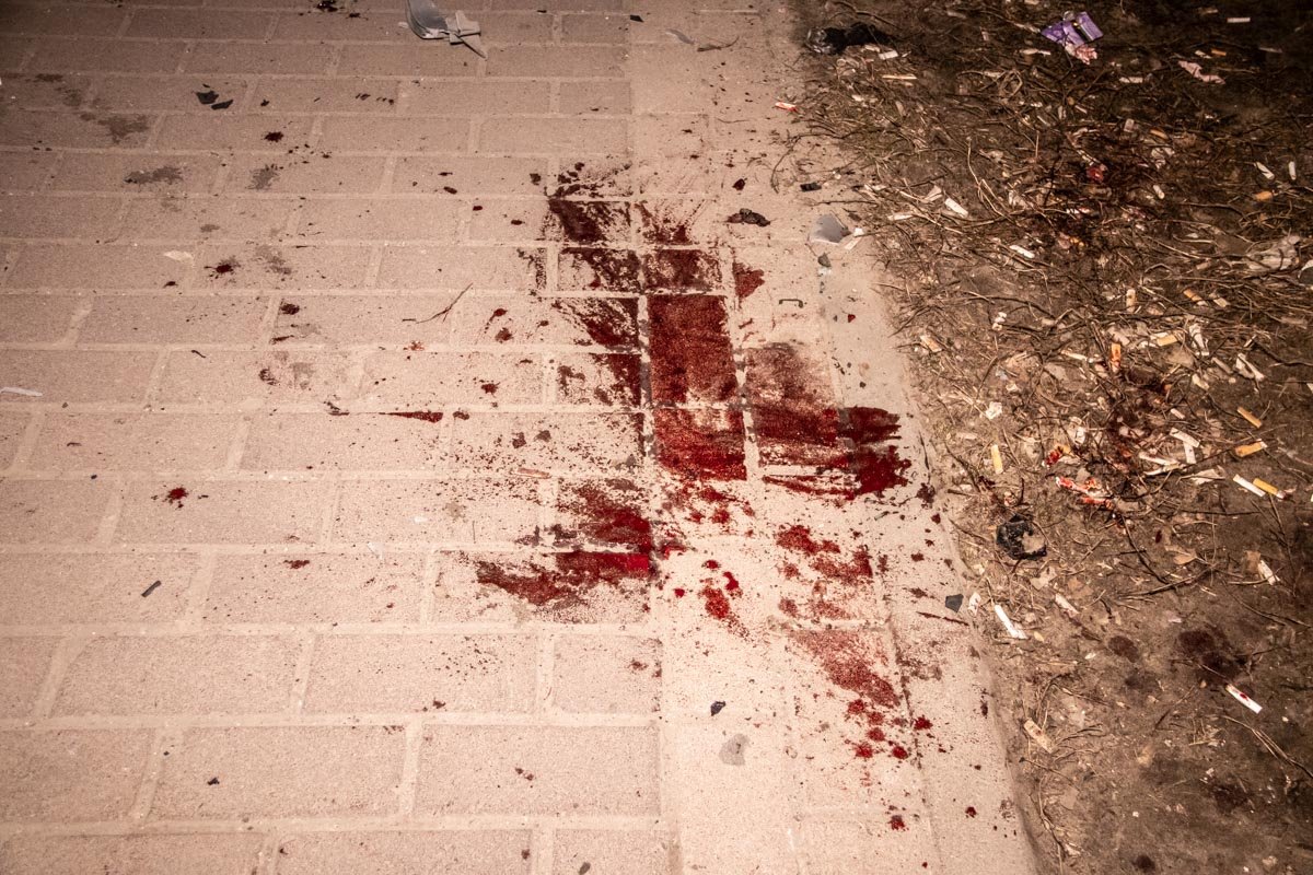 40-летнему мужчине оторвало руку 40-летнему мужчине оторвало руку