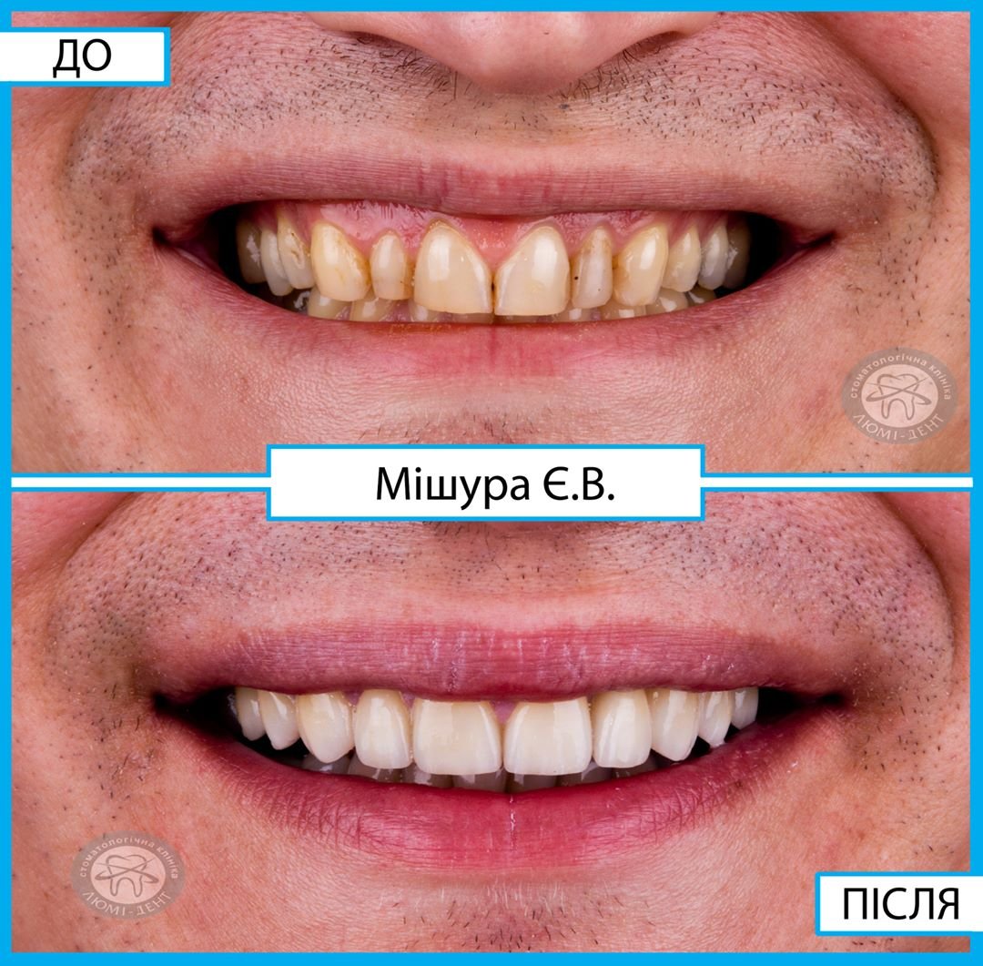 Стоматологии Киева: где найти лучших специалистов и цены на услуги 1