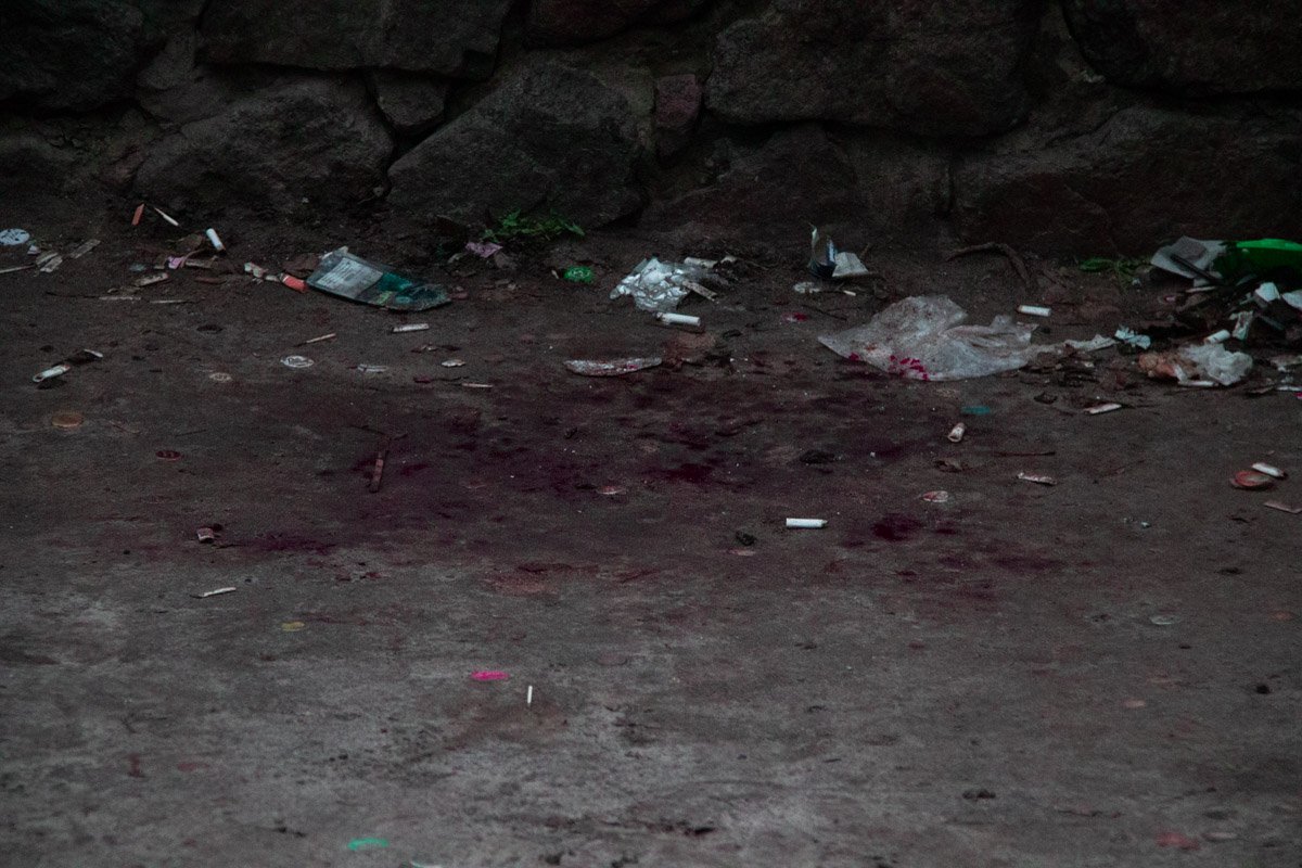 Пострадавшего госпитализировали в больницу Пострадавшего госпитализировали в больницу