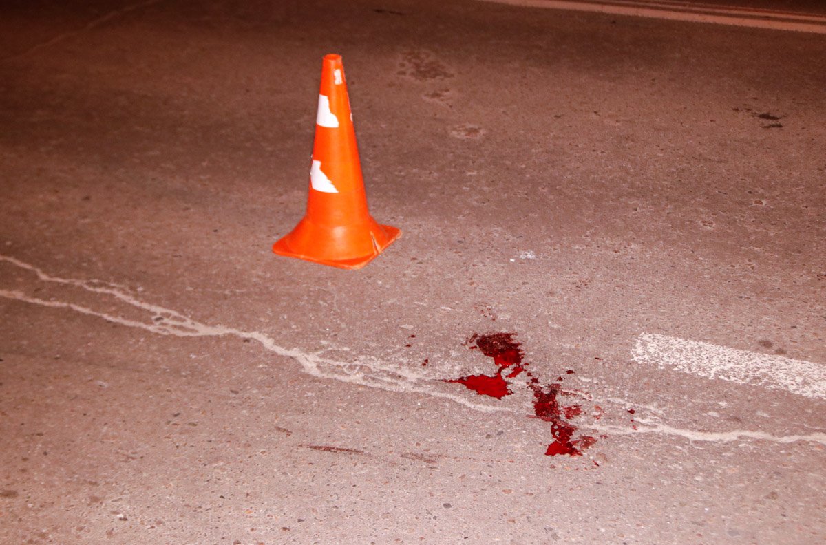 К счастью, пешеход остался жив, его госпитализировали 