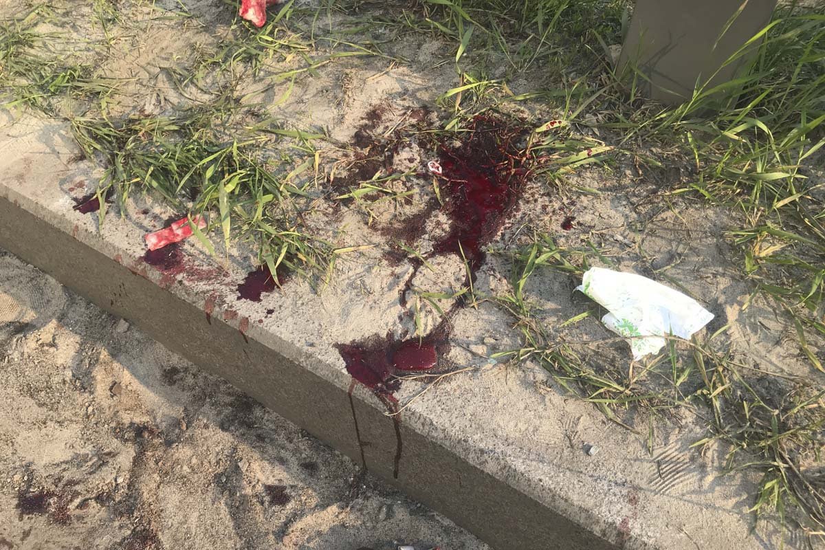 Водитель получил серьезные травмы