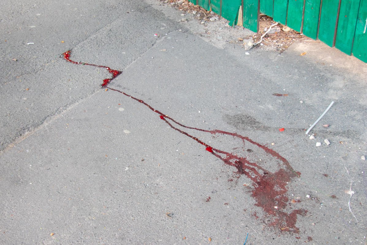 Двоих мужчин и женщину госпитализировали в больницу Двоих мужчин и женщину госпитализировали в больницу