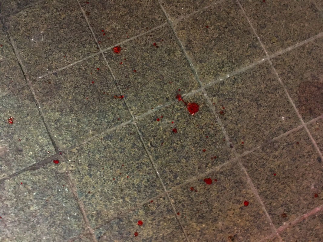 К счастью, обошлось без тяжелых травм К счастью, обошлось без тяжелых травм